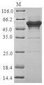 SSB / La Protein - (Tris-Glycine gel) Discontinuous SDS-PAGE (reduced) with 5% enrichment gel and 15% separation gel.