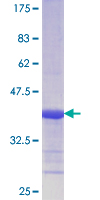 SSB / La Protein - 12.5% SDS-PAGE Stained with Coomassie Blue.