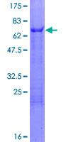 SSBP4 Protein - 12.5% SDS-PAGE of human SSBP4 stained with Coomassie Blue