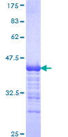 SSBP4 Protein - 12.5% SDS-PAGE Stained with Coomassie Blue.