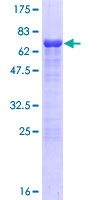 SSDP1 / SSBP3 Protein - 12.5% SDS-PAGE of human SSBP3 stained with Coomassie Blue
