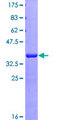 SSDP1 / SSBP3 Protein - 12.5% SDS-PAGE Stained with Coomassie Blue.