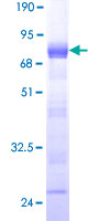 SSFA2 Protein - 12.5% SDS-PAGE of human SSFA2 stained with Coomassie Blue