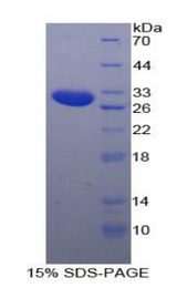 SSFA2 Protein - Recombinant Sperm Specific Antigen 2 By SDS-PAGE