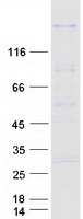 SSFA2 Protein - Purified recombinant protein SSFA2 was analyzed by SDS-PAGE gel and Coomassie Blue Staining