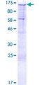 SSH1 Protein - 12.5% SDS-PAGE of human SSH1 stained with Coomassie Blue