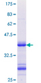 SSH1 Protein - 12.5% SDS-PAGE Stained with Coomassie Blue.