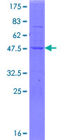 SSH2 Protein - 12.5% SDS-PAGE of human SSH2 stained with Coomassie Blue