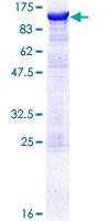 SSH3 Protein - 12.5% SDS-PAGE of human SSH3 stained with Coomassie Blue