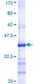 SSH3 Protein - 12.5% SDS-PAGE Stained with Coomassie Blue.
