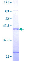 SSNA1 Protein - 12.5% SDS-PAGE of human SSNA1 stained with Coomassie Blue