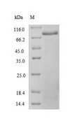 SSNA1 Protein - (Tris-Glycine gel) Discontinuous SDS-PAGE (reduced) with 5% enrichment gel and 15% separation gel.