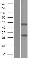 SSPN / Sarcospan Protein - Western validation with an anti-DDK antibody * L: Control HEK293 lysate R: Over-expression lysate
