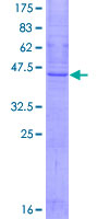 SSPN / Sarcospan Protein - 12.5% SDS-PAGE of human SSPN stained with Coomassie Blue
