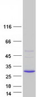 SSPN / Sarcospan Protein - Purified recombinant protein SSPN was analyzed by SDS-PAGE gel and Coomassie Blue Staining