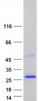 SSPN / Sarcospan Protein - Purified recombinant protein SSPN was analyzed by SDS-PAGE gel and Coomassie Blue Staining
