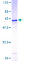 SSR1 Protein - 12.5% SDS-PAGE of human SSR1 stained with Coomassie Blue