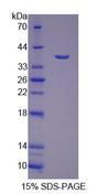 SSR1 Protein - Recombinant Signal Sequence Receptor Alpha (SSRa) by SDS-PAGE