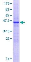 SSR2 Protein - 12.5% SDS-PAGE of human SSR2 stained with Coomassie Blue