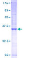 SSR3 / TRAP-Gamma Protein - 12.5% SDS-PAGE of human SSR3 stained with Coomassie Blue