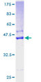 SSR4 Protein - 12.5% SDS-PAGE of human SSR4 stained with Coomassie Blue