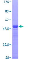 SSSCA1 / p27 Protein - 12.5% SDS-PAGE of human SSSCA1 stained with Coomassie Blue