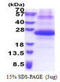 SSSCA1 / p27 Protein
