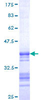 SST / Somatostatin Protein - 12.5% SDS-PAGE Stained with Coomassie Blue.
