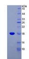 SST / Somatostatin Protein - Recombinant Somatostatin By SDS-PAGE