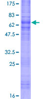 SSTR1 Protein - 12.5% SDS-PAGE of human SSTR1 stained with Coomassie Blue