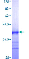 SSTR1 Protein - 12.5% SDS-PAGE Stained with Coomassie Blue.