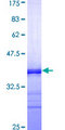 SSTR1 Protein - 12.5% SDS-PAGE Stained with Coomassie Blue.