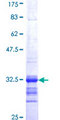 SSTR2 Protein - 12.5% SDS-PAGE Stained with Coomassie Blue.
