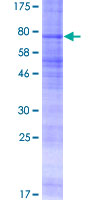 SSTR3 Protein - 12.5% SDS-PAGE of human SSTR3 stained with Coomassie Blue