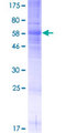 SSTR5 Protein - 12.5% SDS-PAGE of human SSTR5 stained with Coomassie Blue