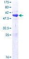 SSU72 Protein - 12.5% SDS-PAGE of human SSU72 stained with Coomassie Blue