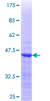 SSX1 Protein - 12.5% SDS-PAGE Stained with Coomassie Blue.