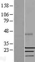 SSX2 Protein - Western validation with an anti-DDK antibody * L: Control HEK293 lysate R: Over-expression lysate