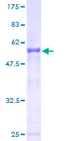 SSX2 Protein - 12.5% SDS-PAGE of human SSX2 stained with Coomassie Blue