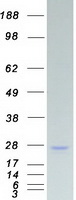 SSX2 Protein - Purified recombinant protein SSX2 was analyzed by SDS-PAGE gel and Coomassie Blue Staining