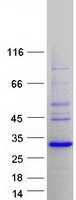 SSX2B Protein - Purified recombinant protein SSX2B was analyzed by SDS-PAGE gel and Coomassie Blue Staining