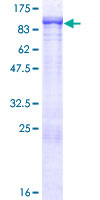 SSX2IP Protein - 12.5% SDS-PAGE of human SSX2IP stained with Coomassie Blue