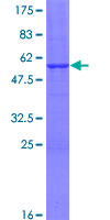 SSX3 Protein - 12.5% SDS-PAGE of human SSX3 stained with Coomassie Blue