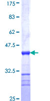 SSX3 Protein - 12.5% SDS-PAGE Stained with Coomassie Blue.