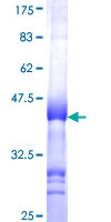 SSX4 Protein - 12.5% SDS-PAGE Stained with Coomassie Blue.