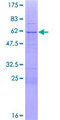 SSX5 Protein - 12.5% SDS-PAGE of human SSX5 stained with Coomassie Blue