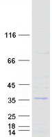 SSX5 Protein - Purified recombinant protein SSX5 was analyzed by SDS-PAGE gel and Coomassie Blue Staining