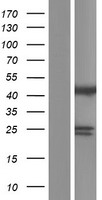 ST13 Protein - Western validation with an anti-DDK antibody * L: Control HEK293 lysate R: Over-expression lysate