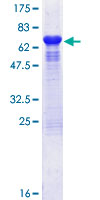 ST13 Protein - 12.5% SDS-PAGE of human ST13 stained with Coomassie Blue