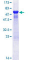 ST13 Protein - 12.5% SDS-PAGE of human ST13 stained with Coomassie Blue